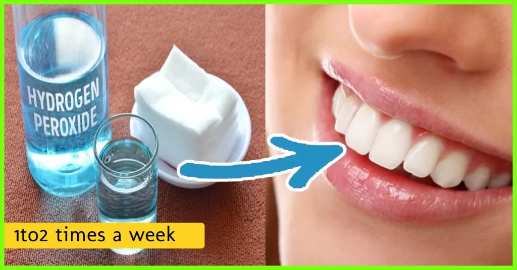 استفاده از هیدروژن پروکسید به صورت یک یا دو بار در هفته برای تمیز کردن دندان ها توصیه می‌شود.